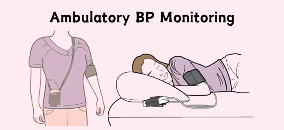 Ambulatory BP Monitoring
